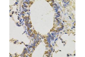 Immunohistochemistry of paraffin-embedded Mouse lung using PTPRC Polyclonal Antibody (CD45 Antikörper)