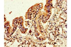 Immunohistochemistry of paraffin-embedded human lung tissue using ABIN7153171 at dilution of 1:100 (FLI1 Antikörper  (AA 205-331))