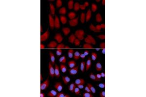 Immunofluorescence analysis of U2OS cell using TAP2 antibody.