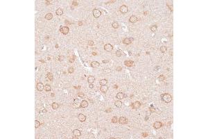 Immunohistochemistry of paraffin-embedded rat brain using KCNJ4 antibody (ABIN6134096, ABIN6142734, ABIN6142737 and ABIN6218214) at dilution of 1:100 (40x lens). (KCNJ4 Antikörper  (AA 50-150))