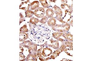 Immunohistochemical analysis of paraffin-embedded M. (SPHK1 Antikörper  (N-Term))