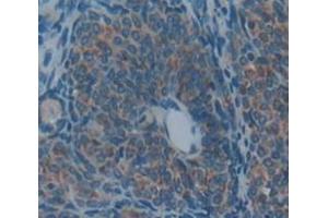 IHC-P analysis of Rat Tissue, with DAB staining. (PZP Antikörper  (AA 1251-1500))
