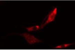 ABIN6275120 staining  HeLa cells by IF/ICC. (EIF3K Antikörper  (N-Term))