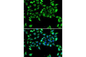 Immunofluorescence analysis of U2OS cells using EIF3H antibody. (EIF3H Antikörper  (AA 80-340))