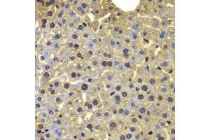 Immunohistochemistry of paraffin-embedded mouse liver using SORT1 antibody (ABIN5975318) at dilution of 1/100 (40x lens).