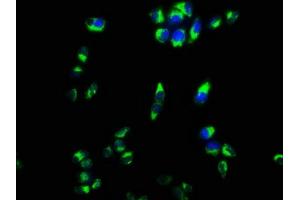 Immunofluorescence staining of Hela cells with ABIN7149348 at 1:133, counter-stained with DAPI. (CPEB4 Antikörper  (AA 244-515))