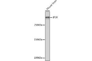 Western blot analysis of extracts of Mouse brain, using IP3R Rabbit mAb (ABIN1679064, ABIN3018927, ABIN3018928 and ABIN7101690) at 1:1000 dilution. (ITPR1 Antikörper)