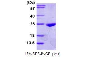 SDS-PAGE (SDS) image for RAB22A, Member RAS Oncogene Family (RAB22A) (AA 1-194) protein (His tag) (ABIN7279560)