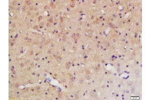 Formalin-fixed and paraffin embedded rat brain labeled with Rabbit Anti-PTPN11 (Tyr584) Polyclonal Antibody, Unconjugated 1:200 followed by conjugation to the secondary antibody and DAB staining (PTPN11 Antikörper  (pTyr584))