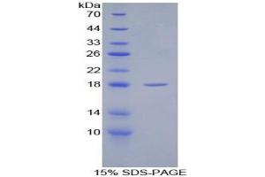 SDS-PAGE analysis of Rat SFRP1 Protein. (SFRP1 Protein)