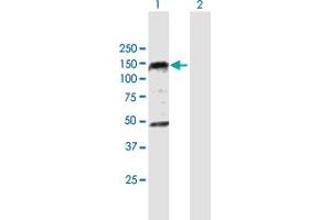 Western Blot analysis of PHC1 expression in transfected 293T cell line by PHC1 MaxPab polyclonal antibody. (PHC1 Antikörper  (AA 1-957))
