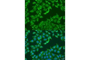 Immunofluorescence analysis of U2OS cells using  antibody  at dilution of 1:100. (ADAP1 Antikörper  (AA 1-374))