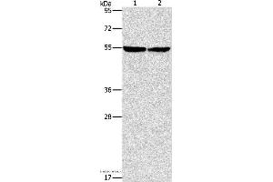 Western blot analysis of Mouse heart tissue and hela cell, using ILK Polyclonal Antibody at dilution of 1:600