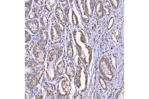 IHC analysis of TOM1L1 using anti-TOM1L1 antibody (ABIN7602631). (TOM1L1 Antikörper  (AA 9-448))