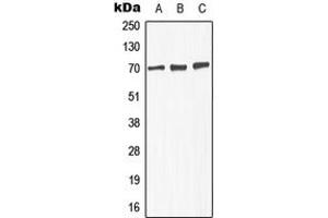 Western blot analysis of GABRA4 expression in MCF7 (A), SP2/0 (B), PC12 (C) whole cell lysates. (GABRA4 Antikörper  (Center))