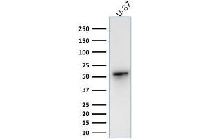 Western Blot Analysis of human U-87 cell lysate using Vimentin Rabbit Recombinant Monoclonal Antibody (VIM/1937R). (Rekombinanter Vimentin Antikörper)