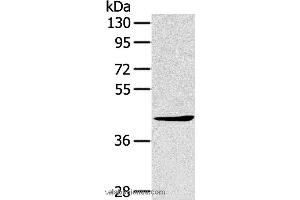 Western blot analysis of A431 cell, using TNIP2 Polyclonal Antibody at dilution of 1:500