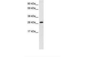 Image no. 2 for anti-Activator of Basal Transcription 1 (Abt1) (AA 174-223) antibody (ABIN202142) (Activator of Basal Transcription 1 Antikörper  (AA 174-223))