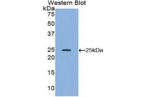 Western blot analysis of the recombinant protein. (ADH1 Antikörper  (AA 25-228))