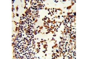 IHC analysis of FFPE human lymph tissue stained with IGHA1 antibody (IGHA1 Antikörper  (AA 257-286))