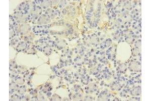 Immunohistochemistry of paraffin-embedded human pancreatic tissue using ABIN7174455 at dilution of 1:100