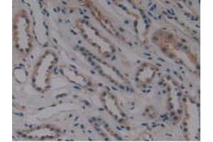 Detection of MPP6 in Human Kidney Tissue using Polyclonal Antibody to Membrane Protein, Palmitoylated 6 (MPP6) (MPP6 Antikörper  (AA 331-503))
