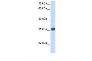 Image no. 1 for anti-Orthodenticle Homeobox 2 (OTX2) (AA 110-159) antibody (ABIN6737647) (OTX2 Antikörper  (AA 110-159))