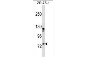 KIF3A Antibody (C-term) (ABIN1537505 and ABIN2850289) western blot analysis in ZR-75-1 cell line lysates (35 μg/lane). (KIF3A Antikörper  (C-Term))