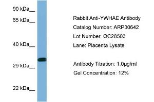 WB Suggested Anti-YWHAE Antibody   Titration: 1.