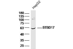 Lane 1: HepG2 lysates probed with BTBD17 Polyclonal Antibody, Unconjugated  at 1:300 overnight at 4˚C. (BTBD17 Antikörper  (AA 101-200))