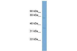 Western Blot showing MFSD8 antibody used at a concentration of 1-2 ug/ml to detect its target protein. (MFSD8 Antikörper  (Middle Region))