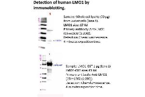 Image no. 1 for anti-LIM Domain Only 1 (Rhombotin 1) (LMO1) antibody (ABIN1112421) (LMO1 Antikörper)