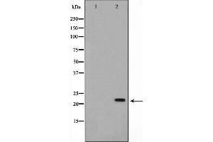 Western blot analysis on K562 cell lysate using NM23 Antibody.
