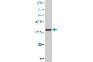 Western Blot detection against Immunogen (31. (IL-8 Antikörper  (AA 21-99))