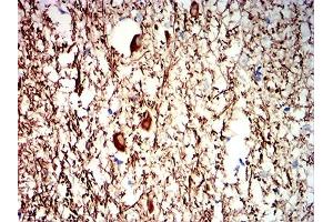Immunohistochemical analysis of paraffin-embedded human medulla oblongata tissues using NEFH mouse mAb with DAB staining. (NEFH Antikörper  (AA 2-251))