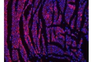 IF analysis of NDUFS2 using anti-NDUFS2 antibody (ABIN7599417).