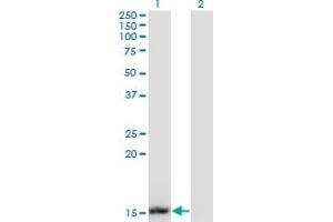 Western Blot analysis of UBE2B expression in transfected 293T cell line by UBE2B monoclonal antibody (M13), clone 1F11.