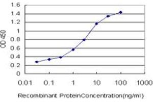 Detection limit for recombinant GST tagged ZIC3 is approximately 0. (ZIC3 Antikörper  (AA 182-274))