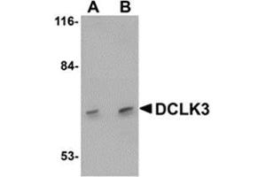 Western blot analysis of DCLK3 in K562 cell lysate with AP30278PU-N DCLK3 antibody at (A) 1 and (B) 2 μg/ml. (DCLK3 Antikörper  (N-Term))