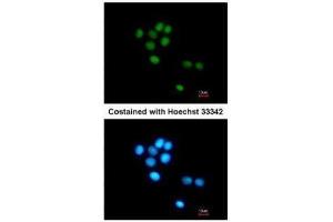 ICC/IF Image Immunofluorescence analysis of methanol-fixed HepG2, using TULP3, antibody at 1:200 dilution. (TULP3 Antikörper)