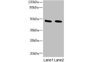 Western blot All lanes: IGSF11 antibody at 1. (IGSF11 Antikörper  (AA 23-241))