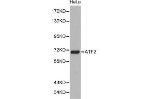 Western Blotting (WB) image for anti-Activating Transcription Factor 2 (ATF2) (AA 1-190) antibody (ABIN6219371) (ATF2 Antikörper  (AA 1-190))