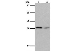 Western Blot analysis of Mouse brain and kidney tissue using KLK7 Polyclonal Antibody at dilution of 1:600 (Kallikrein 7 Antikörper)