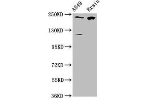 Western Blot Positive WB detected in: A549 whole cell lysate, Rat brain tissue All lanes: CABIN1 antibody at 3. (CABIN1 Antikörper  (AA 1978-2123))