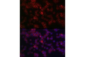 Immunofluorescence analysis of Jurkat cells using CD45 Rabbit pAb (ABIN3022953, ABIN3022954, ABIN3022955, ABIN1513451 and ABIN6219315) at dilution of 1:100 (40x lens). (CD45 Antikörper  (AA 890-990))