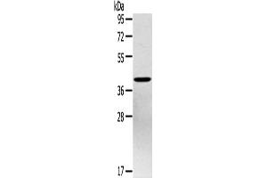Western Blotting (WB) image for anti-Pentraxin 3 (PTX3) antibody (ABIN2434027) (PTX3 Antikörper)
