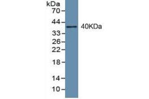 Western Blotting (WB) image for Procollagen I N-Terminal Propeptide (PINP) ELISA Kit (ABIN6574243)