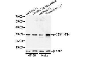 Western blot analysis of extracts of HT-29 and HeLa cells, using Phospho-CDK1-T14 antibody (ABIN5969876) at 1/1000 dilution. (CDK1 Antikörper  (pThr14))