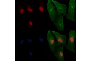 ABIN6265491 and ABIN6266698 staining  cells by IF/ICC. (TBX2/3 Antikörper)