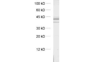 dilution: 1 : 1000, sample: crude synaptosomal fraction of rat brain (P2) (Syntaxin 16 Antikörper  (AA 1-302))